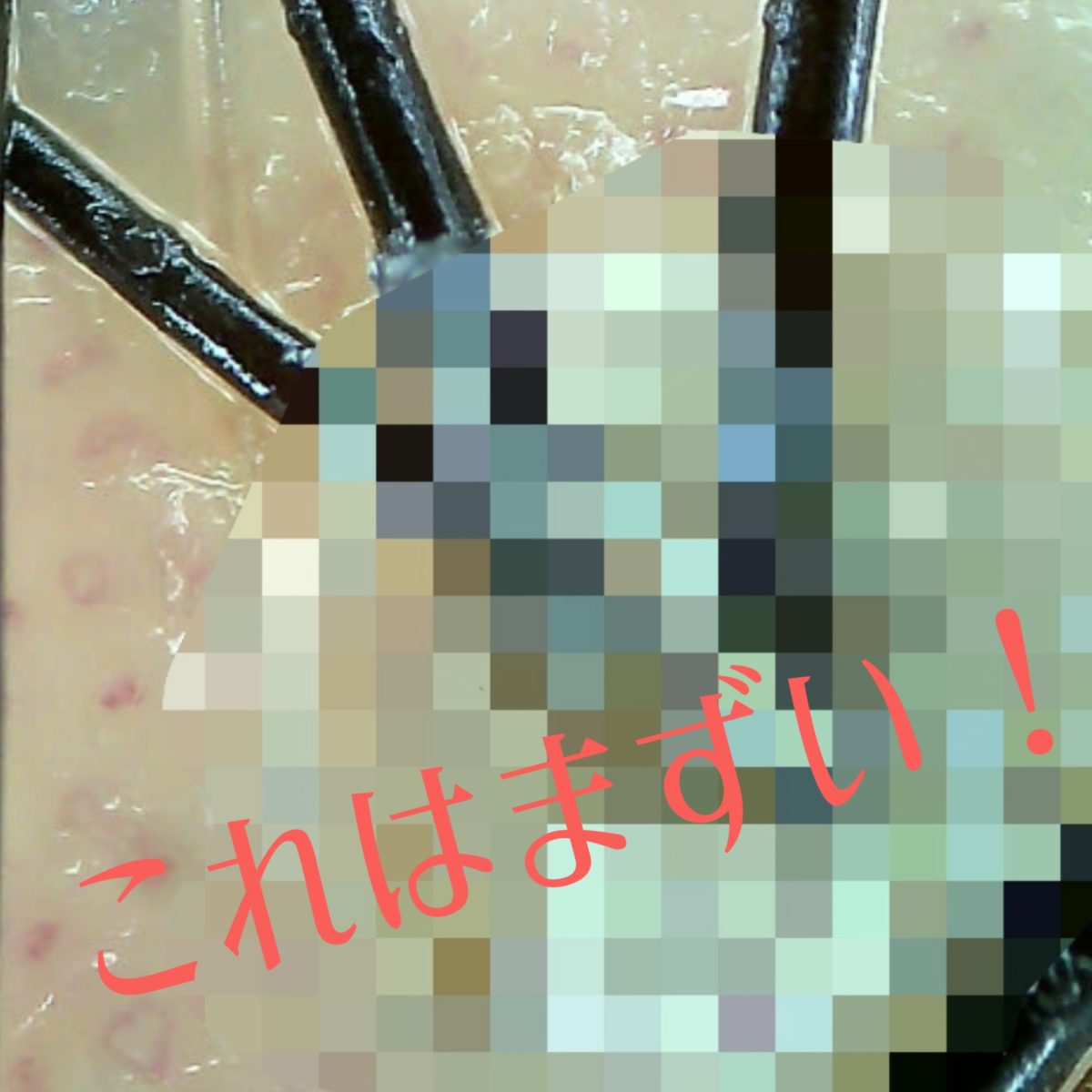 秋は抜け毛の季節!自分の頭皮を知る事から!【浅沼】